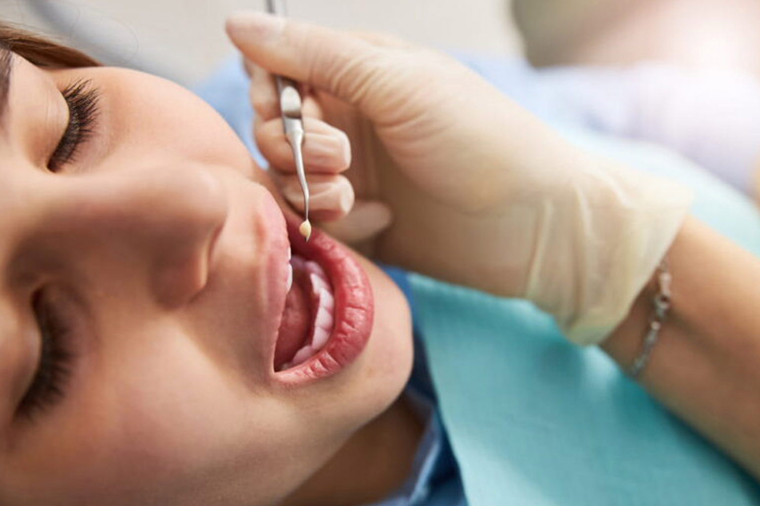 Patient with opened mouth ready for dental restoration with plugger